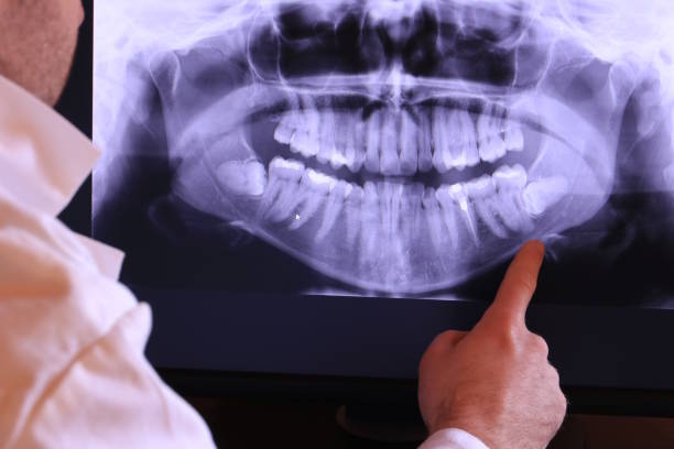 Best Emergency Dental Care for Abscessed Tooth in Newton, AL