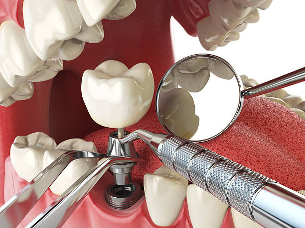 Best Mobile Emergency Dentist in Newton, AL